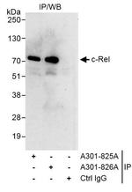 c-Rel Antibody in Immunoprecipitation (IP)