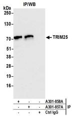 TRIM25 Antibody in Immunoprecipitation (IP)