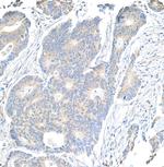 Notch1 Antibody in Immunohistochemistry (Paraffin) (IHC (P))