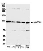 Notch1 Antibody in Western Blot (WB)