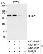 EEA1 Antibody in Immunoprecipitation (IP)