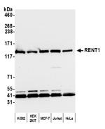 RENT1 Antibody in Western Blot (WB)