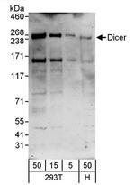 Dicer Antibody in Western Blot (WB)