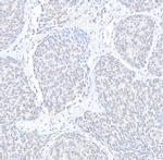 Cyclin K Antibody in Immunohistochemistry (Paraffin) (IHC (P))