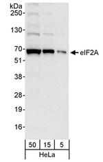 eIF2A Antibody in Western Blot (WB)