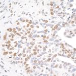 BRD4 Antibody in Immunohistochemistry (Paraffin) (IHC (P))