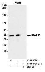 U2AF35 Antibody in Immunoprecipitation (IP)