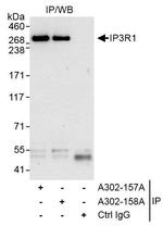IP3R1 Antibody in Immunoprecipitation (IP)