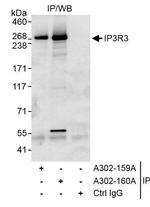 IP3R3 Antibody in Immunoprecipitation (IP)