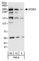 IP3R3 Antibody in Western Blot (WB)