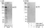 AF6 Antibody in Western Blot (WB)