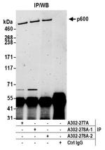 p600 Antibody in Immunoprecipitation (IP)