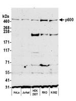 p600 Antibody in Western Blot (WB)