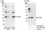 TIGAR Antibody in Western Blot (WB)