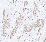 Pc2 Antibody in Immunohistochemistry (Paraffin) (IHC (P))