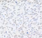 Pc2 Antibody in Immunohistochemistry (Paraffin) (IHC (P))