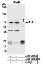 Pc2 Antibody in Immunoprecipitation (IP)