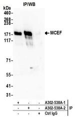 MCEF Antibody in Immunoprecipitation (IP)