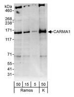 CARMA1 Antibody in Western Blot (WB)