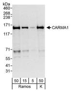 CARMA1 Antibody in Western Blot (WB)