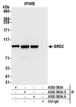 BRD2 Antibody in Immunoprecipitation (IP)