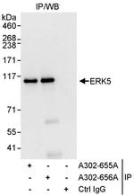 ERK5 Antibody in Immunoprecipitation (IP)