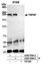 TRPM7 Antibody in Immunoprecipitation (IP)