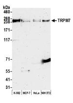 TRPM7 Antibody in Western Blot (WB)