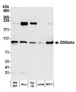 DGKzeta Antibody in Western Blot (WB)