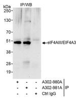 eIF4AIII/EIF4A3 Antibody in Immunoprecipitation (IP)