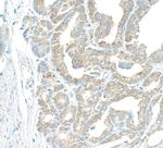 EBP1 Antibody in Immunohistochemistry (Paraffin) (IHC (P))