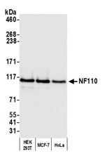 NF110 Antibody in Western Blot (WB)