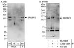 SREBP2 Antibody in Western Blot (WB)