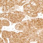 YB1 Antibody in Immunohistochemistry (Paraffin) (IHC (P))