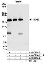 INO80 Antibody in Immunoprecipitation (IP)