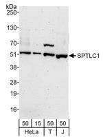 SPTLC1 Antibody in Western Blot (WB)