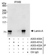 Lamin-A Antibody in Immunoprecipitation (IP)