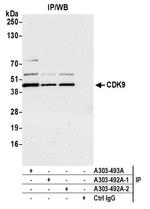 CDK9 Antibody in Immunoprecipitation (IP)