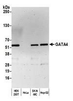 GATA4 Antibody in Western Blot (WB)