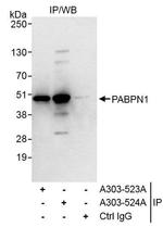 PABPN1 Antibody in Immunoprecipitation (IP)