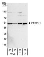 PABPN1 Antibody in Western Blot (WB)