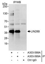 LIN28B Antibody in Immunoprecipitation (IP)