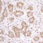 FUS Antibody in Immunohistochemistry (Paraffin) (IHC (P))