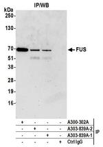 FUS Antibody in Immunoprecipitation (IP)