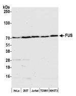 FUS Antibody in Western Blot (WB)