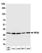 RPS3 Antibody in Western Blot (WB)