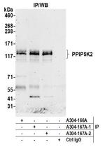 PPIP5K2 Antibody in Immunoprecipitation (IP)