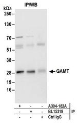 GAMT Antibody in Immunoprecipitation (IP)