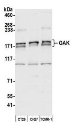 GAK Antibody in Western Blot (WB)