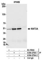 MAT2A Antibody in Immunoprecipitation (IP)